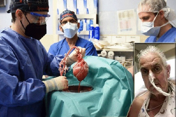 अमेरिकी डॉक्टरों ने रचा इतिहास, दुनिया में पहली बार इंसान को लगाया सुअर का दिल अमेरिकी डॉक्टरों ने रचा इतिहास, दुनिया में पहली बार इंसान को लगाया सुअर का दिल