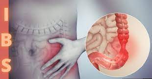 लोकप्रिय रोग - इरिटेबल बॉवेल सिंड्रोम लोकप्रिय रोग - इरिटेबल बॉवेल सिंड्रोम