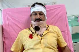 बीजेपी सांसद मनोज तिवारी घायल सफदरजंग अस्पताल में भर्ती बीजेपी सांसद मनोज तिवारी घायल सफदरजंग अस्पताल में भर्ती