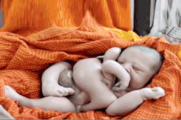 कटिहार सदर अस्पताल में जन्मा चार हाथ-चार पैर वाला बच्चा कटिहार सदर अस्पताल में जन्मा चार हाथ-चार पैर वाला बच्चा