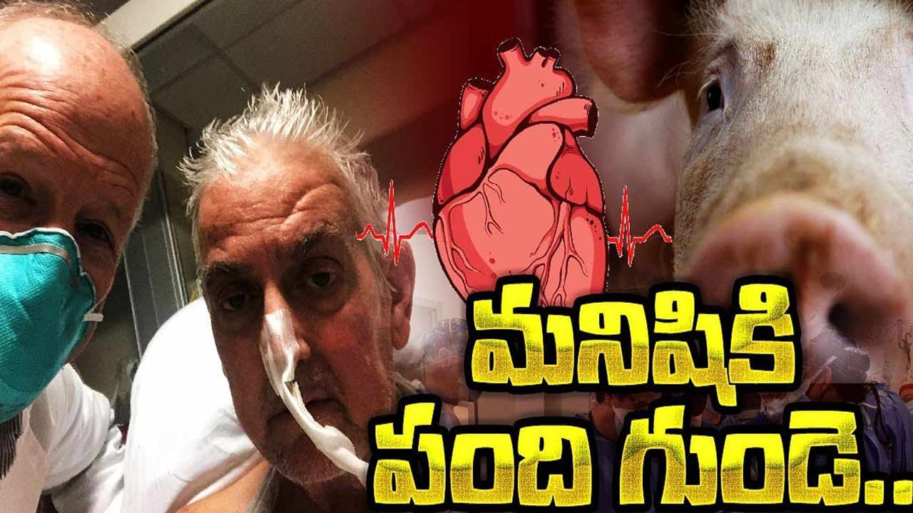 మనిషికి పంది గుండె