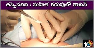 మహిళ కడుపులో కాటన్ ప్యాడ్స్ మహిళ కడుపులో కాటన్ ప్యాడ్స్