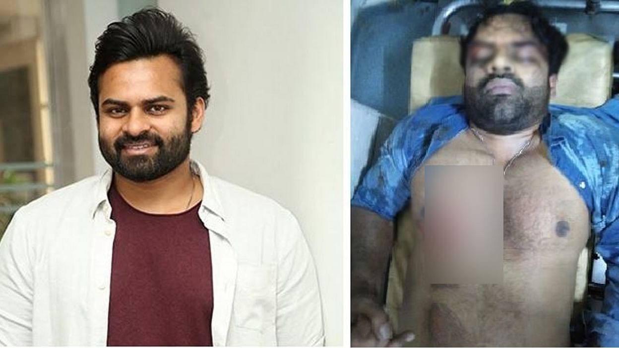 సాయి ధరమ్ తేజ్ ని పరామర్శించి న తలసాని సాయి ధరమ్ తేజ్ ని పరామర్శించి న తలసాని